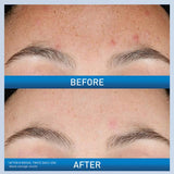 Cerave  Resurfacing Retinol Serum